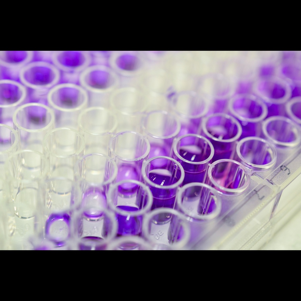 l carnitine test What specific blood tests are required before initiating carnitine (L- carnitine) supplementation? main image 0